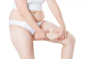 thigh lift in turkey