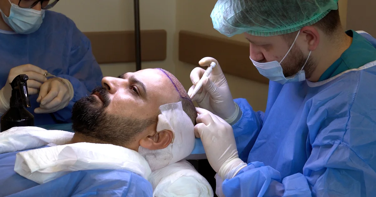 Haartransplantation