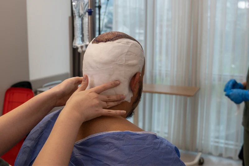 المنطقة المانحة بعد زراعة الشعر مع ضماد في الجزء الخلفي من الرأس