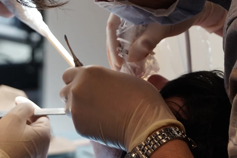 Türkiye’de All-on-4 implant tedavisinin uygulama aşaması