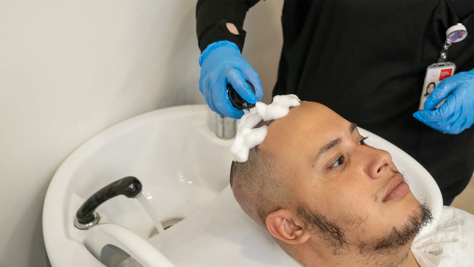 أول غسيل بعد زراعة الشعر