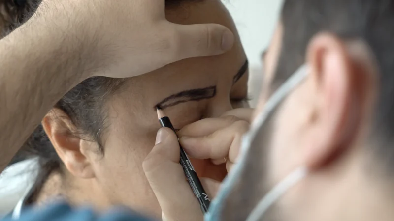 Cejas naturales después de un trasplante de cejas en Turquía