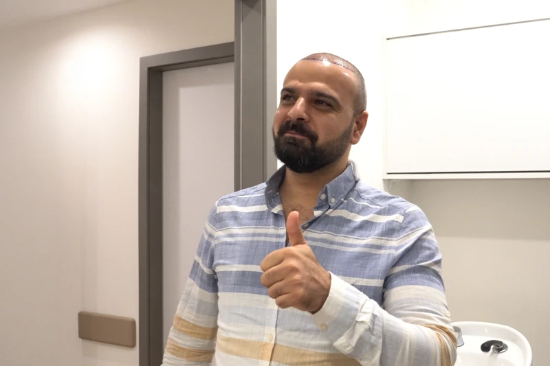 مريض راضٍ عن نتائج زراعة الشعر