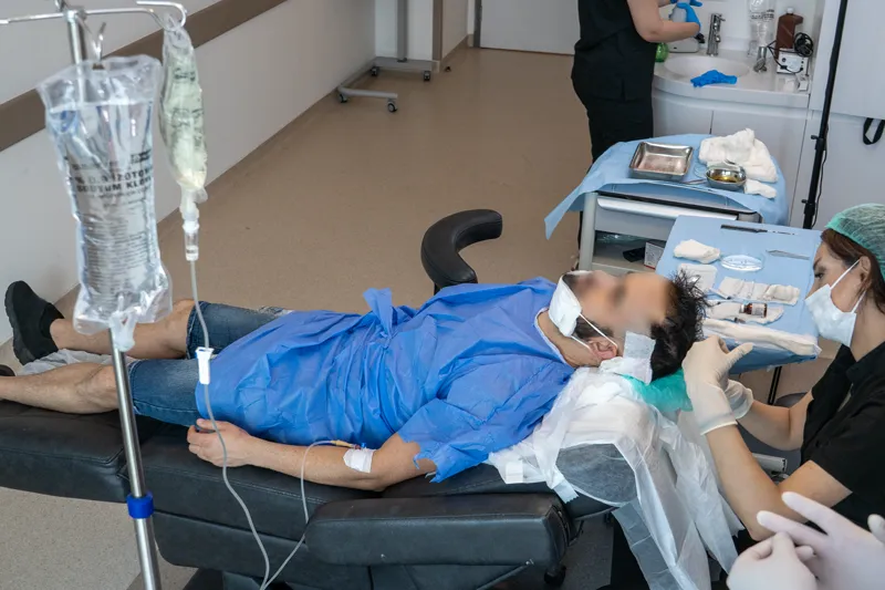 زراعة بصيلات الشعر في المنطقة المستهدفة