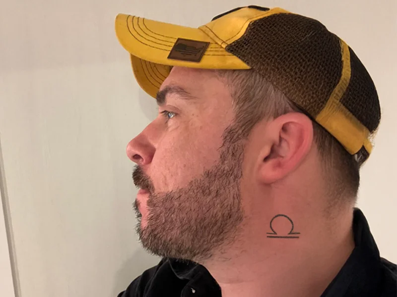 Trasplante de Barba en Turquía - Turk Aesthetic Trasplante de barba a los 6 meses