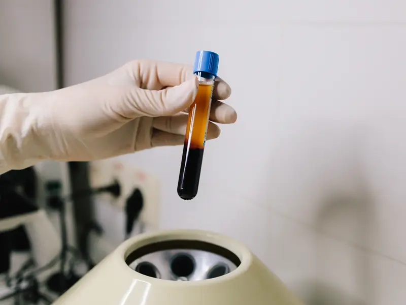 İstanbul da P-Shot Fiyatları