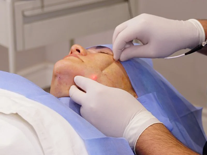 istanbul da endolift