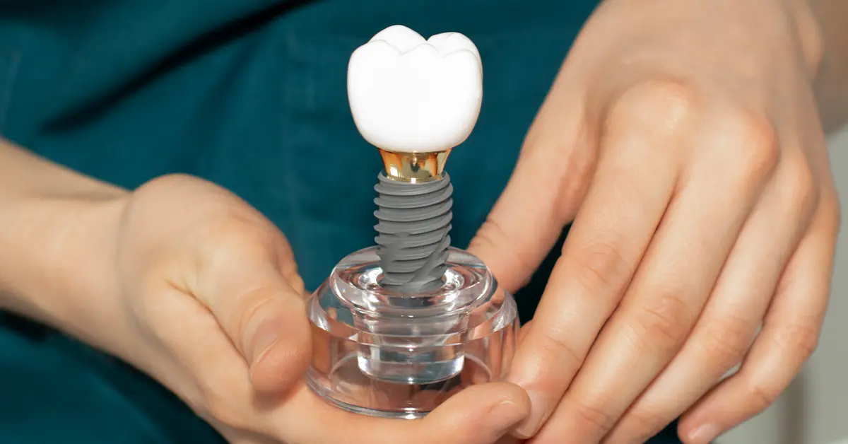 İstanbul da Diş İmplantı