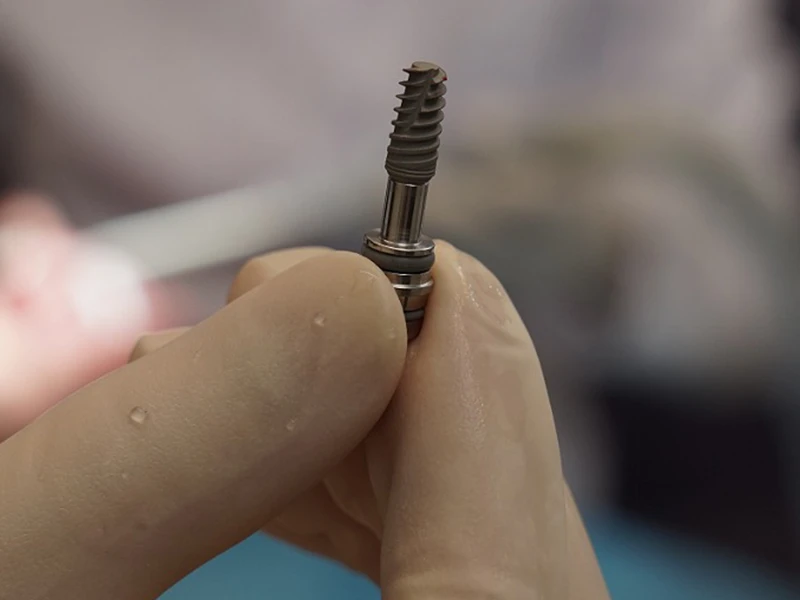 İstanbul da Diş İmplantı