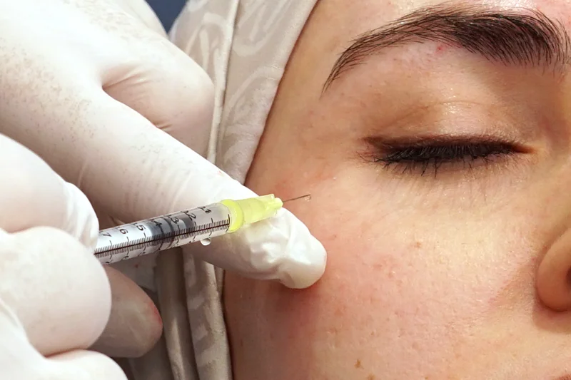botoks enjeksiyonu uygulaması