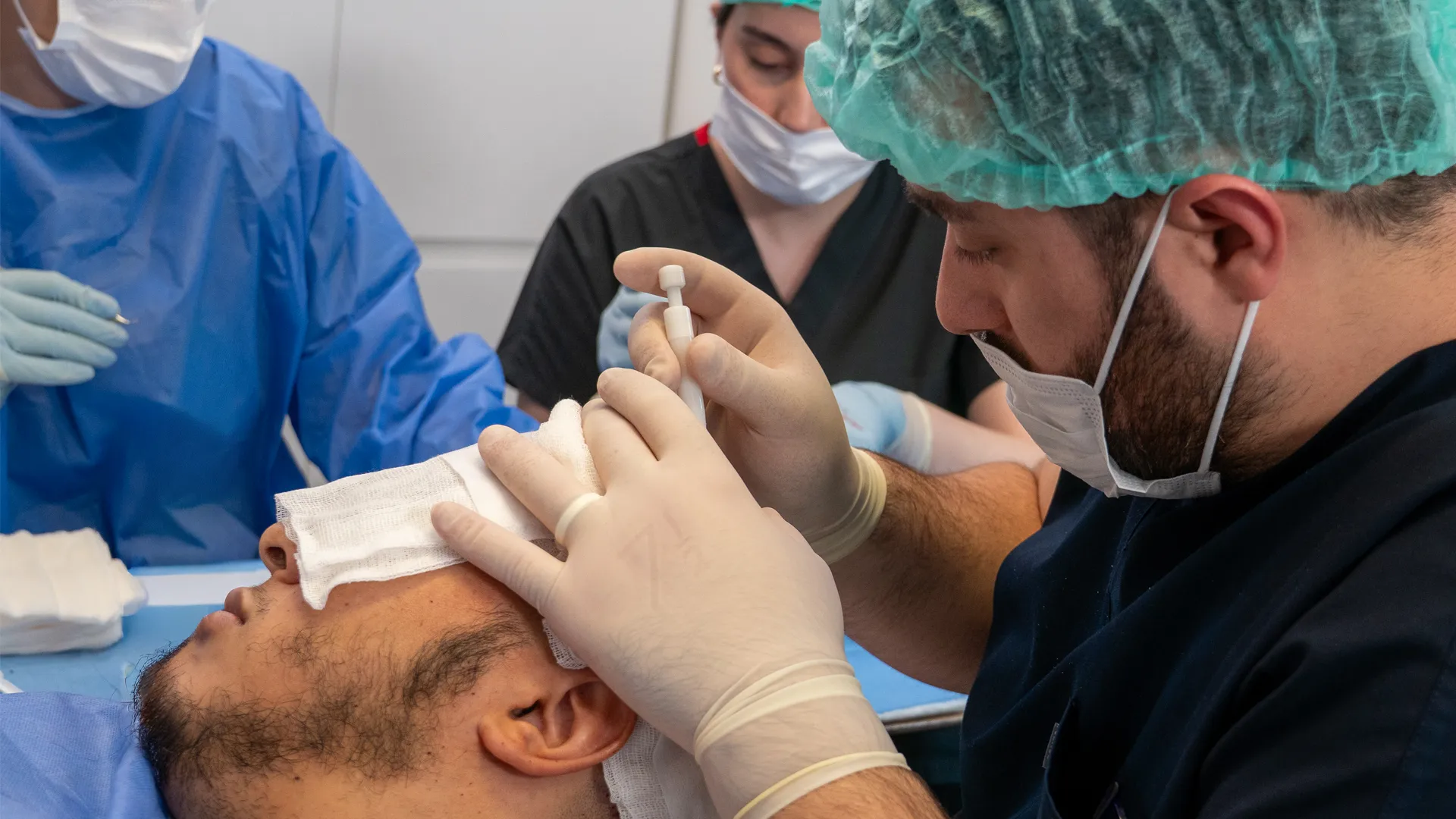 زراعة الشعر بتقنية DHI مع زرع مباشر لبصيلات الشعر بنتائج طبيعية