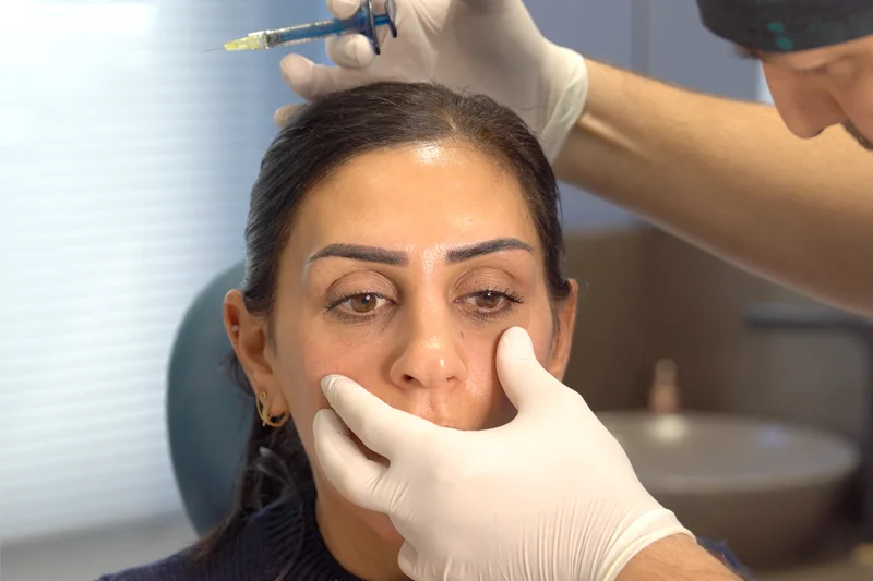 إجراء حقن فيلر تحت العين أثناء العلاج