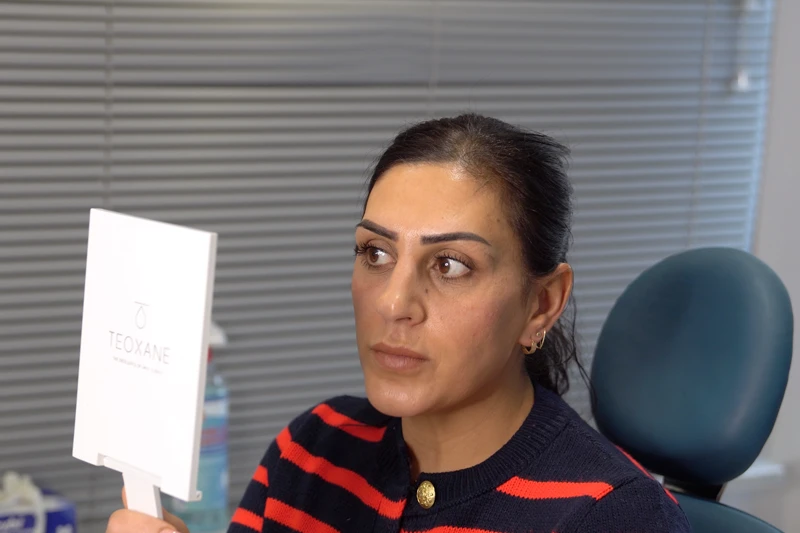 Patient looking in the mirror after under eye filler in Turkey