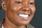 Hollywood Smile result from the right angle after treatment