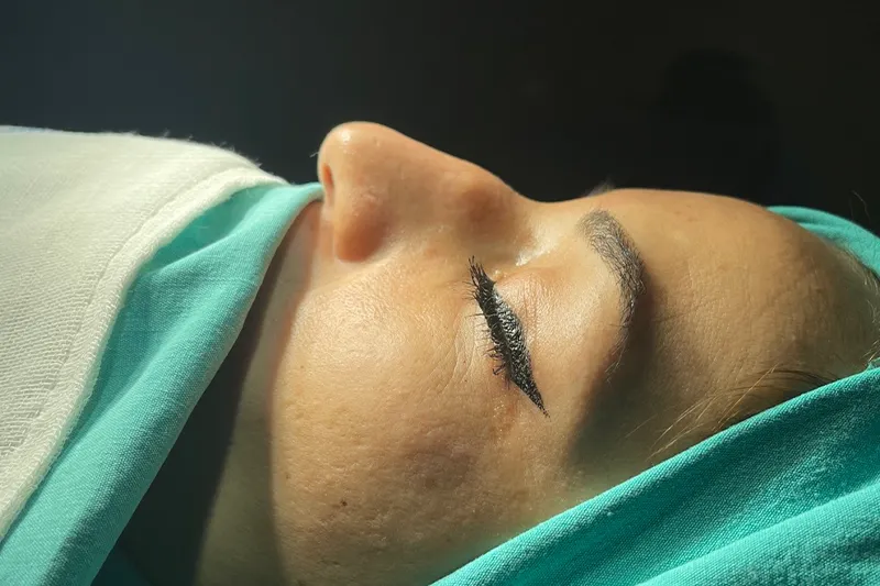 ظاهر بینی قبل از جراحی بینی