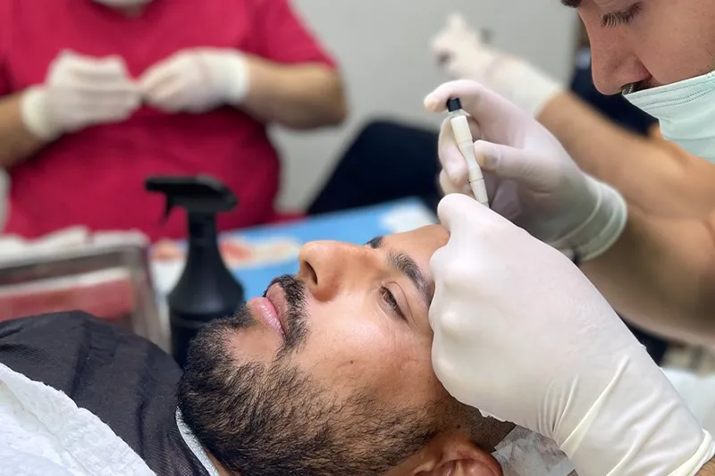 dhi-hair-transplant-procedure