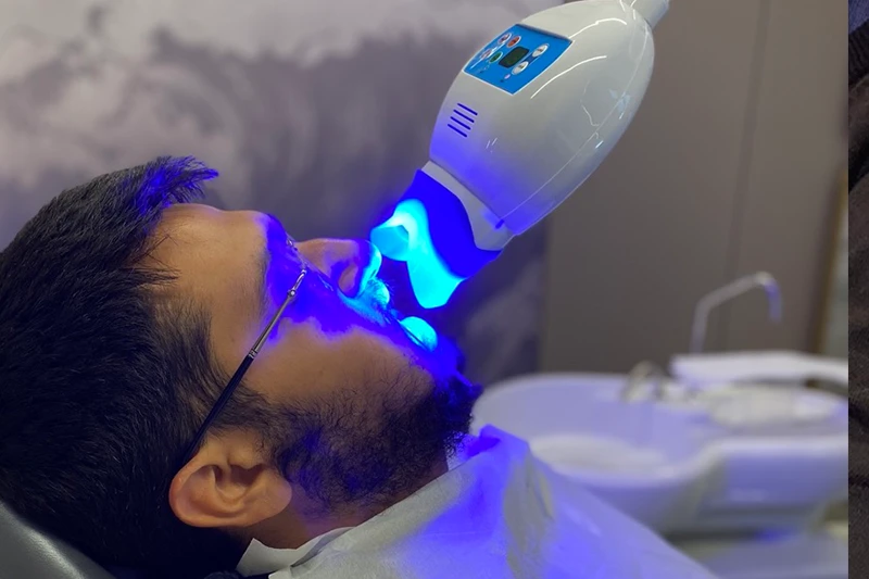 Lichtaktivierungsphase während einer professionellen Laser-Zahnaufhellung.