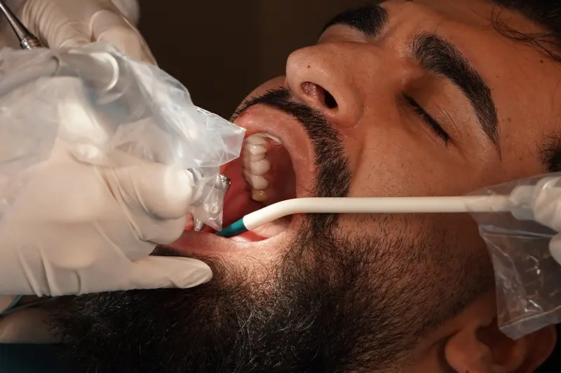Zirkonyum kaplama işlemi sırasında klinik uygulama