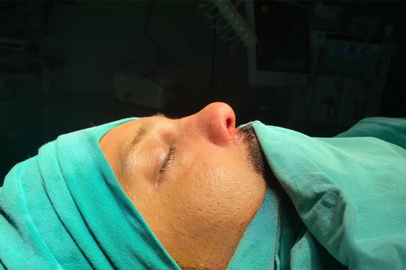 جراحی زیبایی بینی مردان متناسب با ویژگی‌های صورت