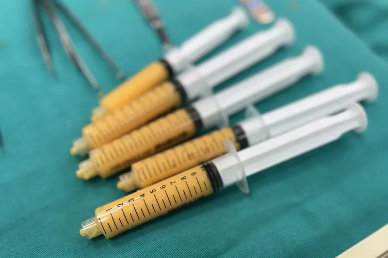 Penis büyütme için hazırlanan saflaştırılmış yağ greftleri
