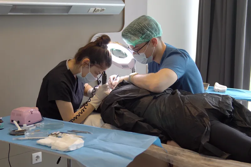Sorgfältige Entnahme von Haargrafts aus dem Spenderbereich bei einer Haartransplantation für Frauen.