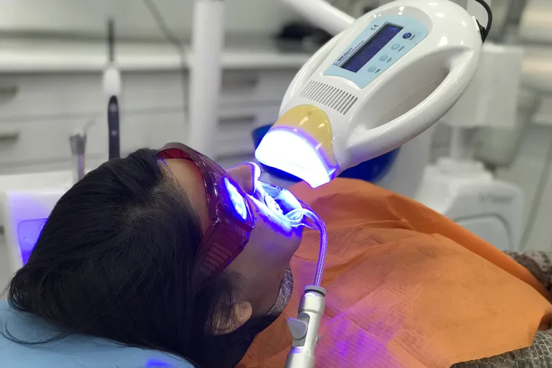 Diş beyazlatma sırasında lazer veya ışık uygulaması